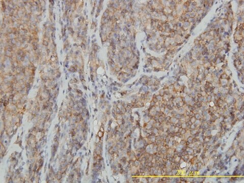 Monoclonal Anti-RHOA antibody produced in mouse clone 1B12, purified immunoglobulin, buffered aqueous solution