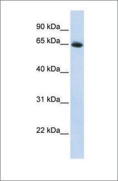 Anti-SLC2A4 antibody produced in rabbit affinity isolated antibody