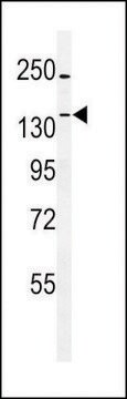 ANTI-TTBK1(N-TERMINAL) antibody produced in rabbit affinity isolated antibody, buffered aqueous solution