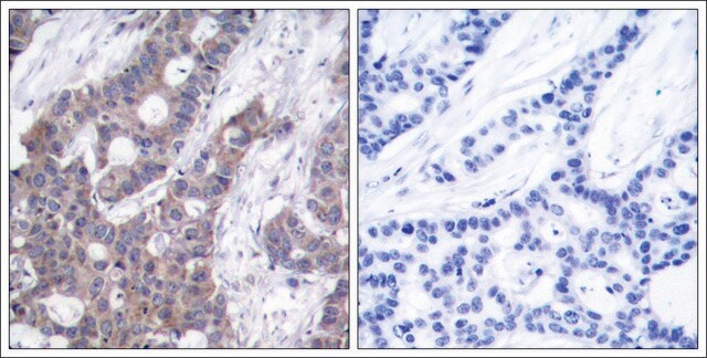 Anti-phospho-STMN1 (pSer16) antibody produced in rabbit affinity isolated antibody