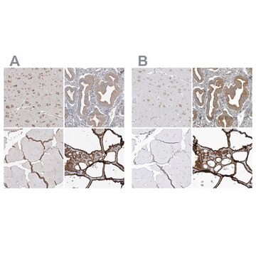 Anti-PDIA6 antibody produced in rabbit Prestige Antibodies&#174; Powered by Atlas Antibodies, affinity isolated antibody, buffered aqueous glycerol solution