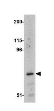 Anti-ASAH2 Antibody from rabbit, purified by affinity chromatography