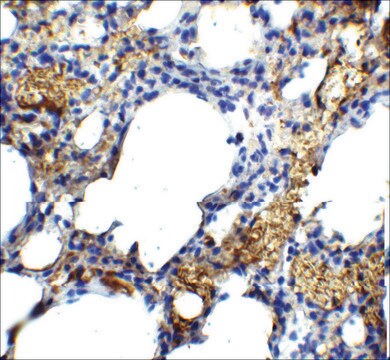 Anti-TM4SF1 antibody produced in rabbit affinity isolated antibody