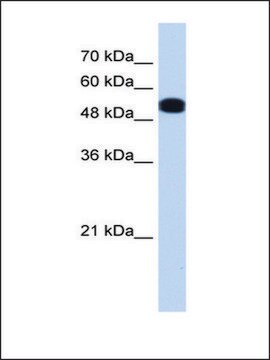 Anti-UGP2 antibody produced in rabbit affinity isolated antibody