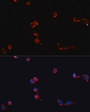 Anti-CAT antibody produced in rabbit