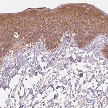 Anti-KRT1 antibody produced in rabbit Prestige Antibodies&#174; Powered by Atlas Antibodies, affinity isolated antibody, buffered aqueous glycerol solution