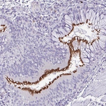 Anti-INAFM1 antibody produced in rabbit Prestige Antibodies&#174; Powered by Atlas Antibodies, affinity isolated antibody, buffered aqueous glycerol solution