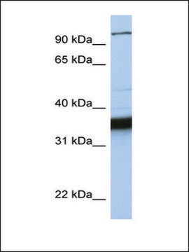 Anti-KIFC3 antibody produced in rabbit affinity isolated antibody