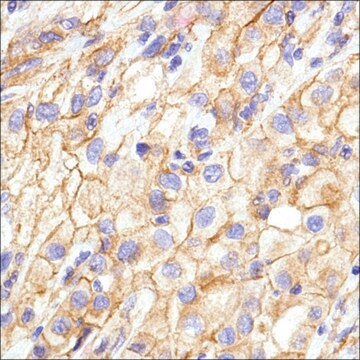 Anti-N-Cadherin, Rabbit monoclonal recombinant, expressed in proprietary host, clone SP90, affinity isolated antibody