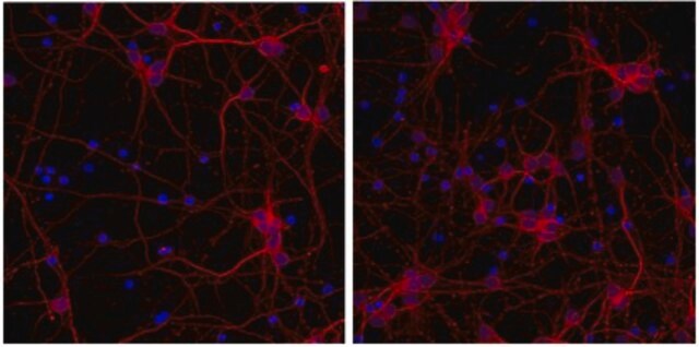 Anti-Tubulin &#946;-III Antibody, clone TU-20, Alexa Fluor&#8482;555 Conjugate clone TU-20, from mouse, ALEXA FLUOR&#8482; 555