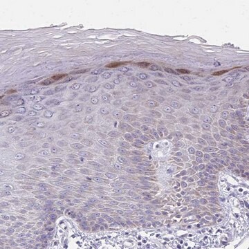 Anti-IL37 antibody produced in rabbit Prestige Antibodies&#174; Powered by Atlas Antibodies, affinity isolated antibody, buffered aqueous glycerol solution