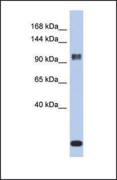 Anti-ATXN7 antibody produced in rabbit affinity isolated antibody