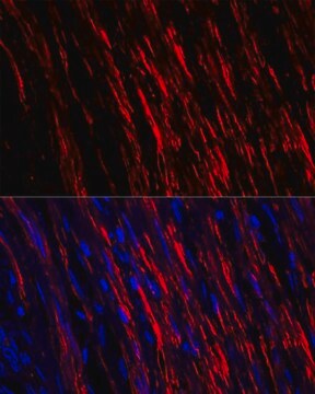 Anti-alpha smooth muscle actin antibody produced in rabbit