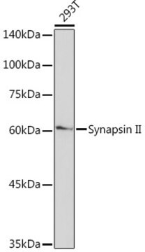 Anti-Synapsin II Antibody, clone 7J6L0, Rabbit Monoclonal