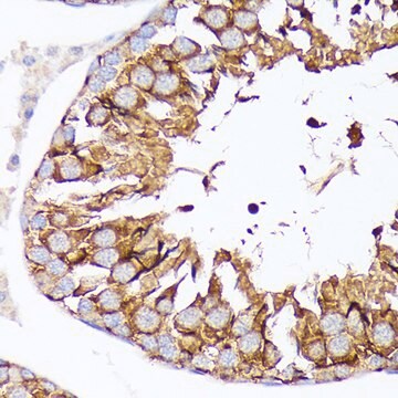 Anti-Nectin 2/CD112 Antibody, clone 3H0G2, Rabbit Monoclonal