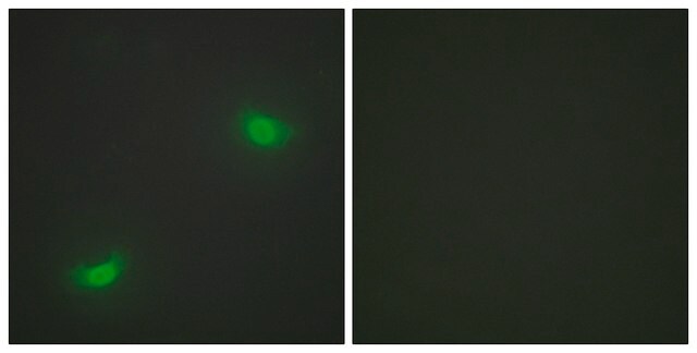 Anti-DUSP16 antibody produced in rabbit affinity isolated antibody