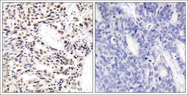 Anti-RELA (Ab-529) antibody produced in rabbit affinity isolated antibody