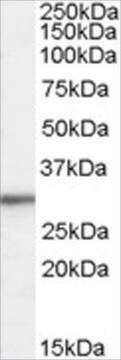 Anti-Ribosomal Protein L8 antibody produced in goat affinity isolated antibody, buffered aqueous solution