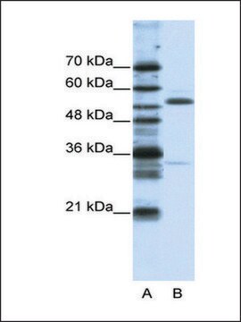 Anti-ZNF655 antibody produced in rabbit IgG fraction of antiserum