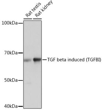 Anti-TGF beta induced (TGFBI) Antibody, clone 7Q5O9, Rabbit Monoclonal