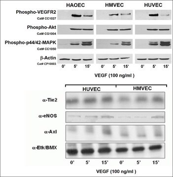 Human Aortic Endothelial Cells: HAOEC: Pre-Screened for Angiogenesis &amp; VEGF signaling, adult