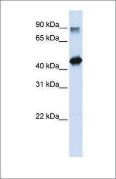 Anti-HMG20A antibody produced in rabbit affinity isolated antibody