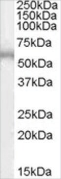 Anti-ADRB1 antibody produced in goat affinity isolated antibody, buffered aqueous solution