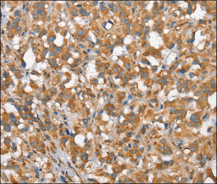 Anti-CSMD1 antibody produced in rabbit affinity isolated antibody