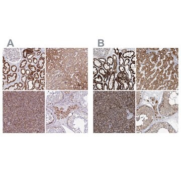 Anti-SUCLG2 antibody produced in rabbit Prestige Antibodies&#174; Powered by Atlas Antibodies, affinity isolated antibody, buffered aqueous glycerol solution