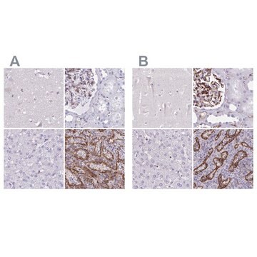 Anti-PITPNM3 antibody produced in rabbit Prestige Antibodies&#174; Powered by Atlas Antibodies, affinity isolated antibody, buffered aqueous glycerol solution