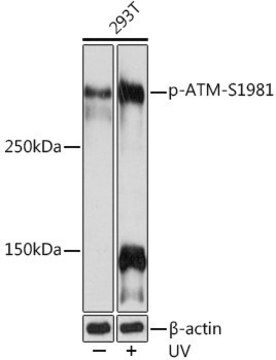 Anti-Phospho-ATM-S1981 antibody produced in rabbit