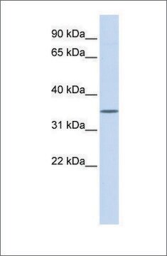 Anti-WNT1 antibody produced in rabbit affinity isolated antibody