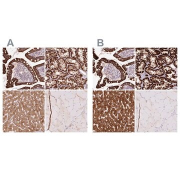 Anti-PCK2 antibody produced in rabbit Prestige Antibodies&#174; Powered by Atlas Antibodies, affinity isolated antibody, buffered aqueous glycerol solution