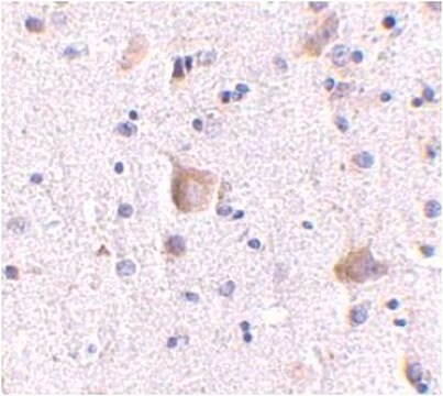 Anti-RIM 2 Antibody from rabbit, purified by affinity chromatography