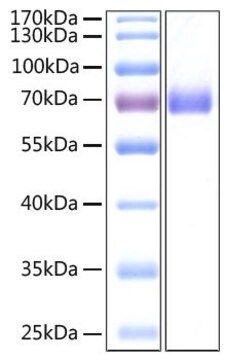 Recombinant 2019-nCoV Spike S2 ECD Protein with His tag