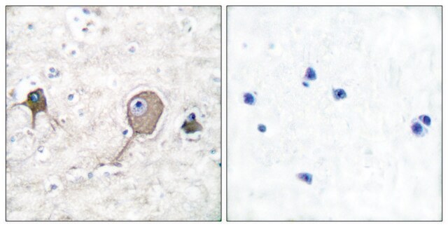 Anti-NSE antibody produced in rabbit affinity isolated antibody