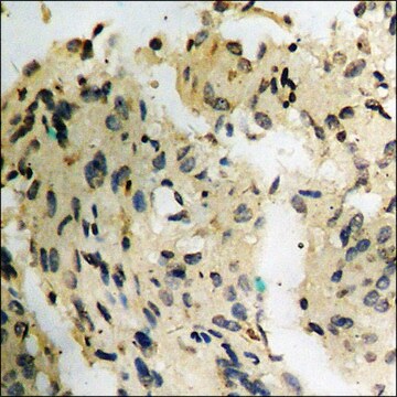 Anti-phospho-ZAP-70 (pTyr493) antibody produced in rabbit affinity isolated antibody