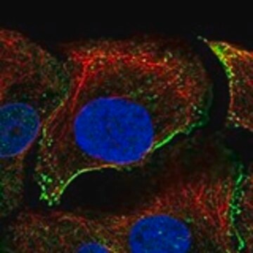 Anti-DAG1 antibody produced in rabbit Prestige Antibodies&#174; Powered by Atlas Antibodies, affinity isolated antibody, buffered aqueous glycerol solution