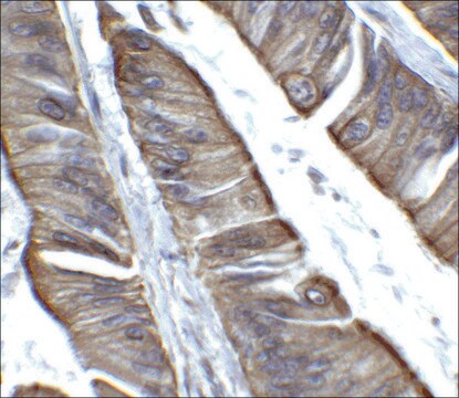 Anti-TET2 antibody produced in rabbit affinity isolated antibody