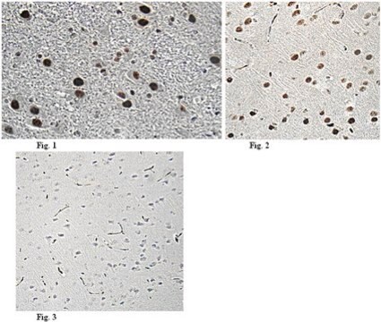 Anti-Bcl-2-associated transcription factor 1 Antibody from rabbit, purified by affinity chromatography