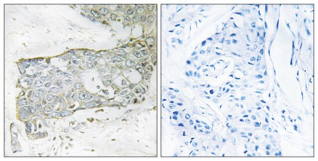 Anti-FA7 (light chain, Cleaved-Arg212) antibody produced in rabbit affinity isolated antibody