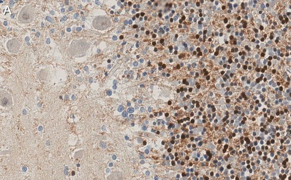 Anti-p27 Kip1 Antibody, clone 1B10 ZooMAb&#174; Rabbit Monoclonal recombinant, expressed in HEK 293 cells