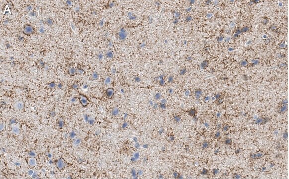 Anti-GAD67 Antibody, clone 1G10.2 ZooMAb&#174; Mouse Monoclonal recombinant, expressed in HEK 293 cells