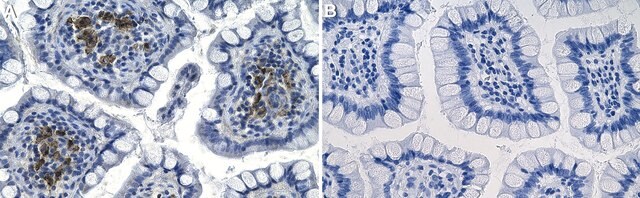 Anti-RANKL/TNFSF11 Antibody, clone 1H17 ZooMAb&#174; Rabbit Monoclonal recombinant, expressed in HEK 293 cells