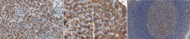 Anti-MPK-3 (DUSP6) Antibody, clone 5H6.1 clone 5H6.1, from mouse