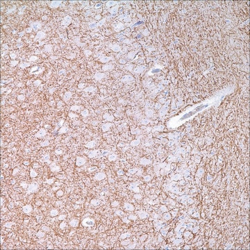 Neurofilament (2F11) Mouse Monoclonal Antibody