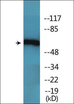 Anti-phospho-Chk2 (pThr68) antibody produced in rabbit affinity isolated antibody