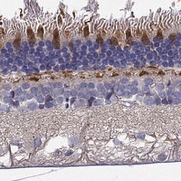 Anti-GRK7 antibody produced in rabbit Prestige Antibodies&#174; Powered by Atlas Antibodies, affinity isolated antibody, buffered aqueous glycerol solution