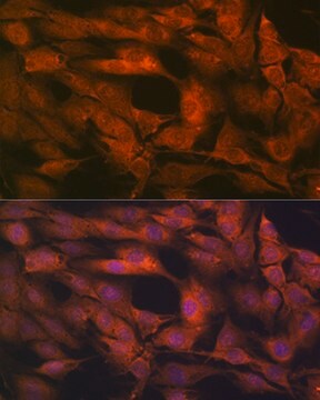 Anti-Laminin beta 1 Antibody, clone 6I9T4, Rabbit Monoclonal