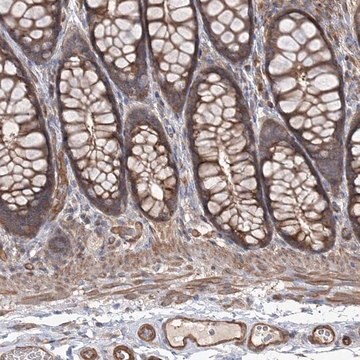 Anti-LARS2 antibody produced in rabbit Prestige Antibodies&#174; Powered by Atlas Antibodies, affinity isolated antibody, buffered aqueous glycerol solution